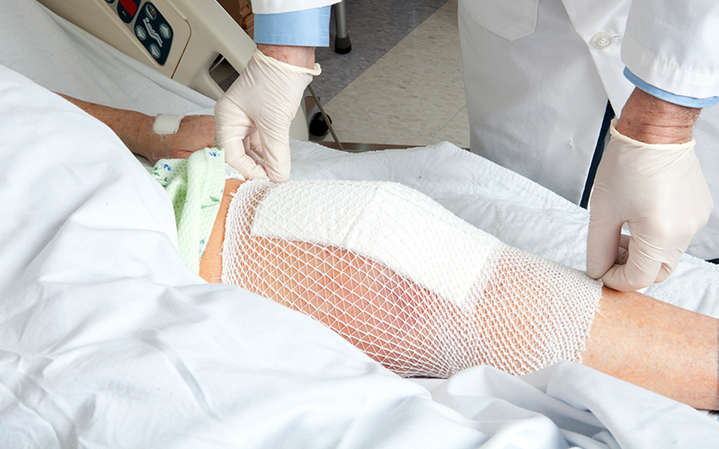 Disability Benefits of Total Knee Replacement